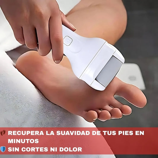 Dile Adiós a los Talones Agrietados – Exfoliador Recargable
